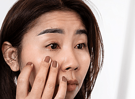 Eye Allergies