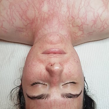 Observ Skin Analysis &ndash; Body Beautiful Retreat &ndash; Brisbane