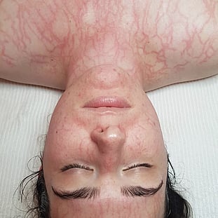 Observ Skin Analysis – Body Beautiful Retreat – Brisbane