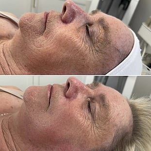 Observ Skin Analysis – Body Beautiful Retreat – Brisbane