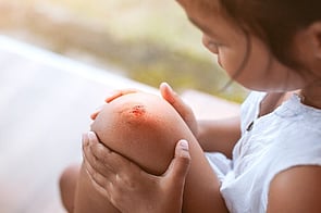 Skin Infections