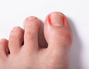 Toe Pain Isn&rsquo;t Normal&mdash;Here&rsquo;s What&rsquo;s Actually Causing It