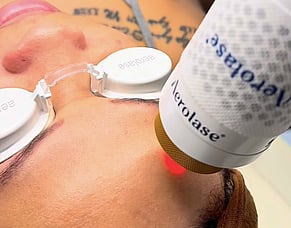 Introducing our new Technology - Aerolase Neo Elite