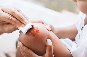 Wound Care