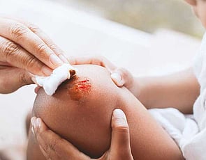 First Aid