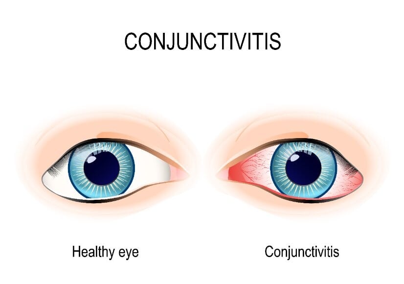 Eye Care | Taita Pharmacy