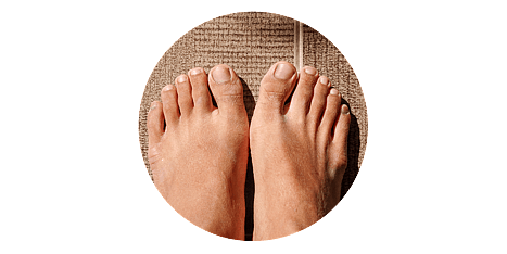 Toenail Care
