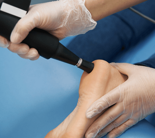 Shockwave Therapy Foot Foundation