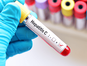 Hepatitis C Testing