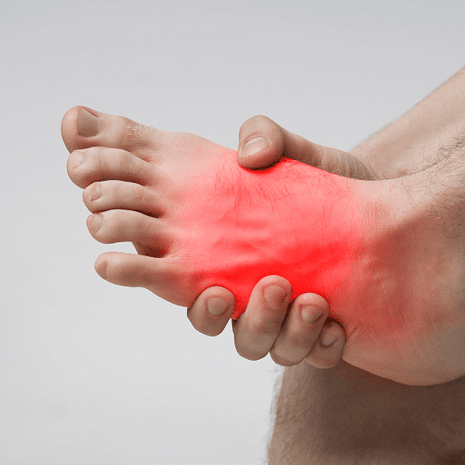 Specialist podiatry care for high arches with orthotics, strengthening, and footwear advice at Foot Foundation