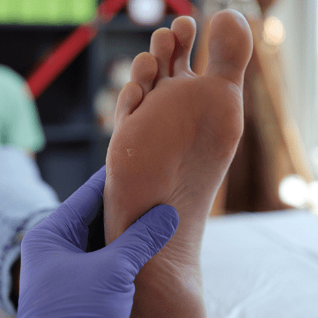 Specialist podiatry care for Morton&rsquo;s neuroma with orthotics, footwear optimisation, and nerve pain relief at Foot Foundation