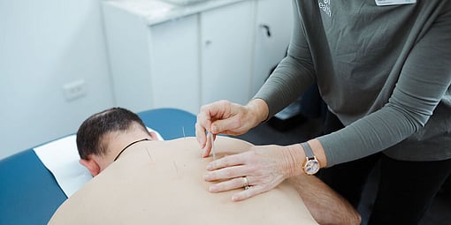 Acupuncture is a form of traditional Chinese medicine which has been around for over two thousand years.