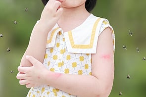 Insect Repellent