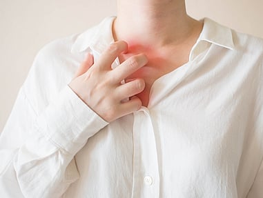 fungal skin infections