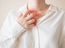 fungal skin infections