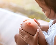 skin Infections