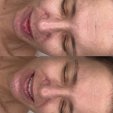 Observ Skin Analysis – Body Beautiful Retreat – Brisbane
