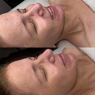 Observ Skin Analysis &ndash; Body Beautiful Retreat &ndash; Brisbane