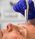 A nanopusion pro pen being using on a lady in the salon by a beauty therapist wearing purple disposable gloves