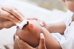 Wound Care