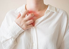 Fungal Skin Infections