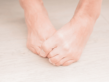 Athlete's Foot