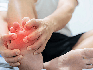 Gout Education and Management