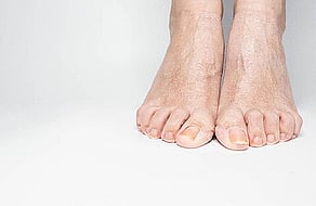 Nail Infections