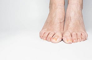 Nail Infections