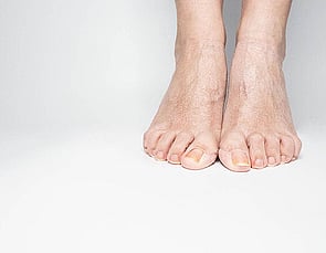 Nail Infections