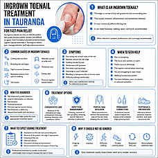 Ingrown Toenail Treatment in Tauranga