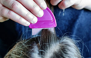 Funded Head Lice Treatment