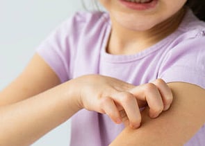 Funded Scabies Treatment