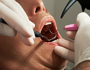 Smoking and gum disease: the hidden connection