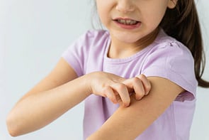 Funded Scabies Treatment