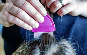 Funded Head Lice Treatment