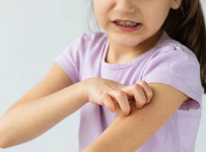 Funded Scabies Treatment