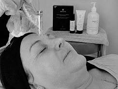 “Microneedling treatment at Jo’s Beauty Room Patumahoe”