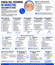 Fungal Nail Treatment Hamilton: Your Complete Guide