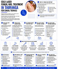 Cold Laser Fungal Nail Treatment in Tauranga