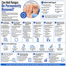 Cold Laser vs Oral Medication for Nail Fungus