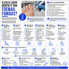 Is Cold Laser Worth It for Toenail Fungus?