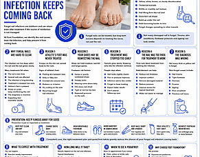 Why Your Fungal Nail Infection Keeps Coming Back