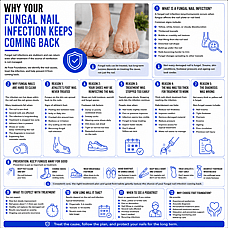 Why Your Fungal Nail Infection Keeps Coming Back