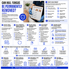 Can Nail Fungus Be Permanently Removed?