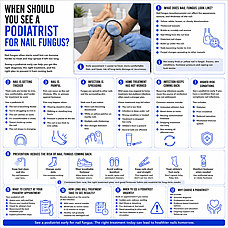 When Should You See a Podiatrist for Nail Fungus?