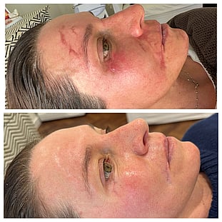 Observ Skin Analysis – Body Beautiful Retreat – Brisbane